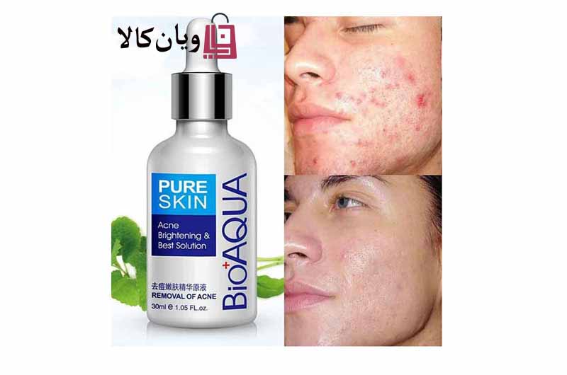 سرم درمانی، ترمیم کننده و ضدجوش صورت بیوآکوا مدل PURE SKIN