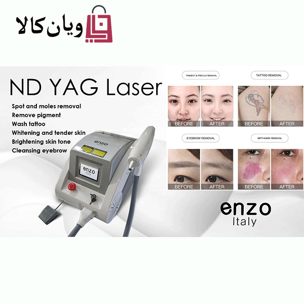 لیزر کیوسوییچ اندیاگ برند انزوایتالی ۲