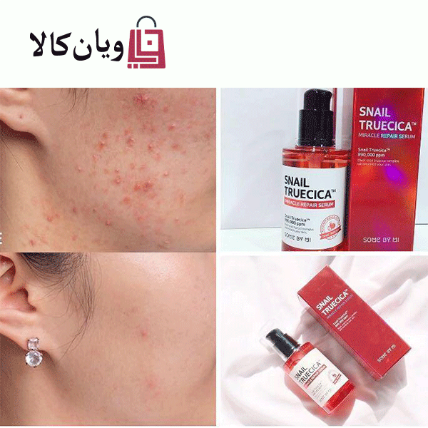 سرم معجزه هیالورنیک اسید حلزون سیاه روشان Roushun حجم 50 میل 3